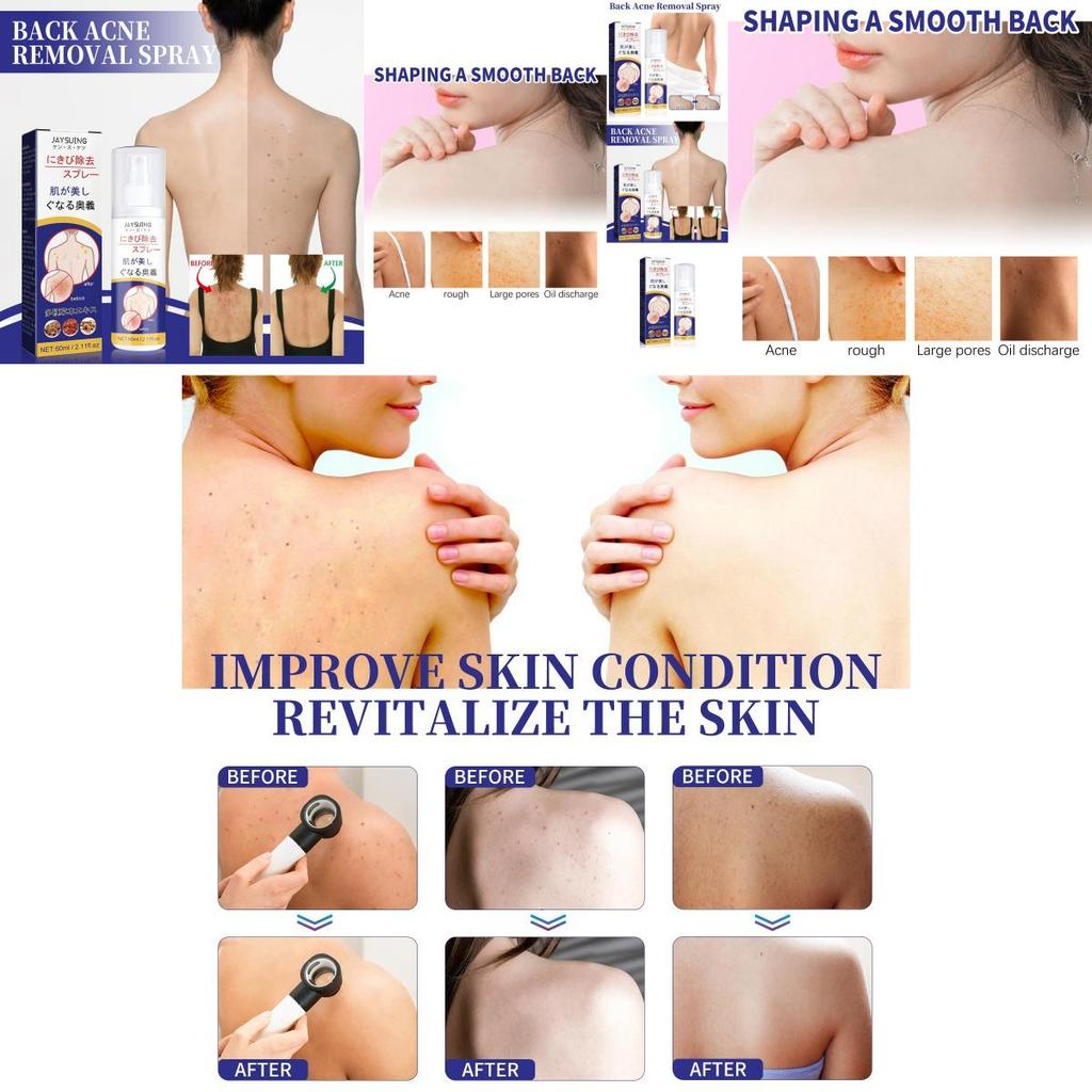 Jaysuing Back Care Spray For Fading Acne Marks And Smoothing Skin Texture