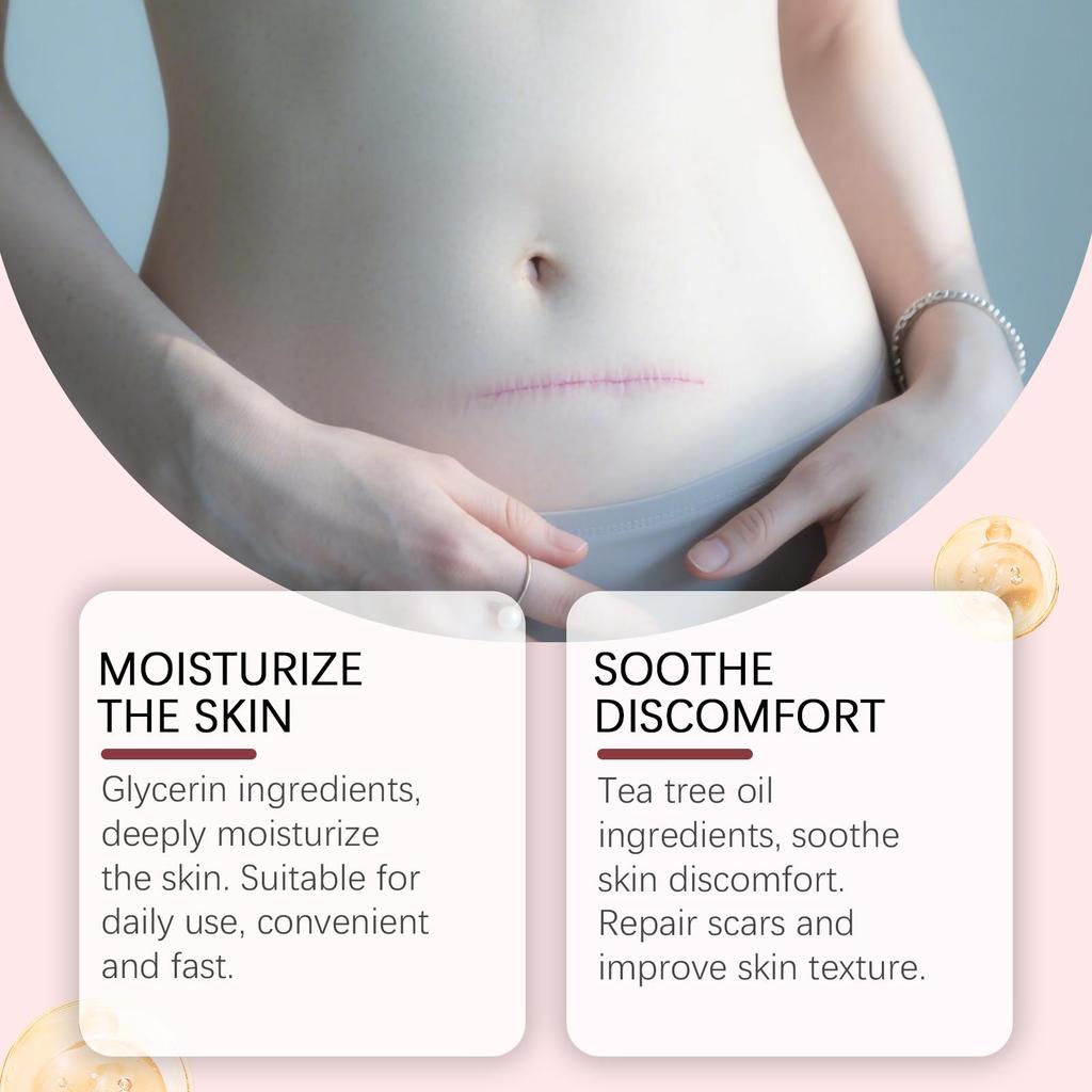 XIMONTH Scar Care Patches, Gentle Formula 24-Hour Breathable and Skin-Friendly Reduces Hypertrophic Scars