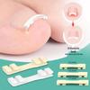 Nickel-Titanium Ingrown Toenail Corrector: Invisible, Wearable Nail Hook for Pain Relief