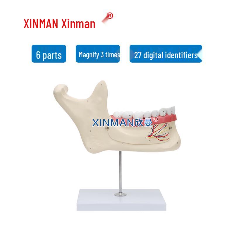 XINMAN Adult Dentition Enlarged Dental Teaching Model