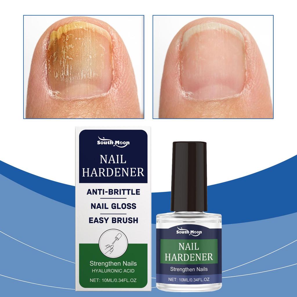 Nagelhärteröl Fördert Wachstum Repariert Brüchige Verfärbte Nägel Hand-Fuß-Pilzentfernung Anti-Paronychie Nagelhärteröl