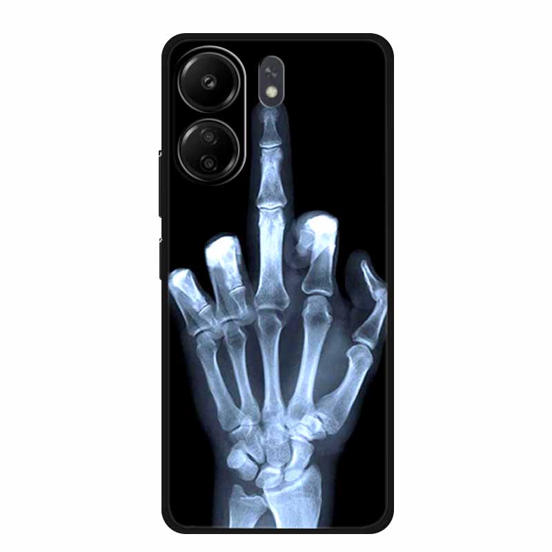 For Xiaomi Poco X7 Pro 5G Luxury Animal Case Soft Silicone TPU 6.67"Phone Back Cover for Poco X7Pro 5GShockproof Protective Capa