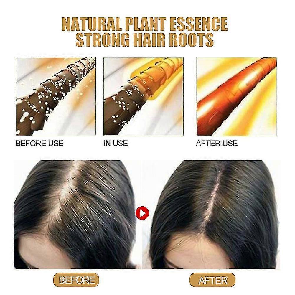 1-3pcs Natural Ginger Hair Regrowth Shampoo Bar, Promotes Hair Growth, Anti Hair Loss Shampoo Soap - PJ