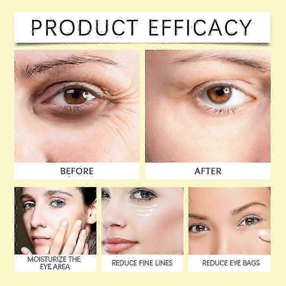 Bee Venom Eye Cream Remove Dark Circles Lightening Anti Eye Bag Puffiness Firming Skin Fade Fine Lines Nourish Lifting Skincare