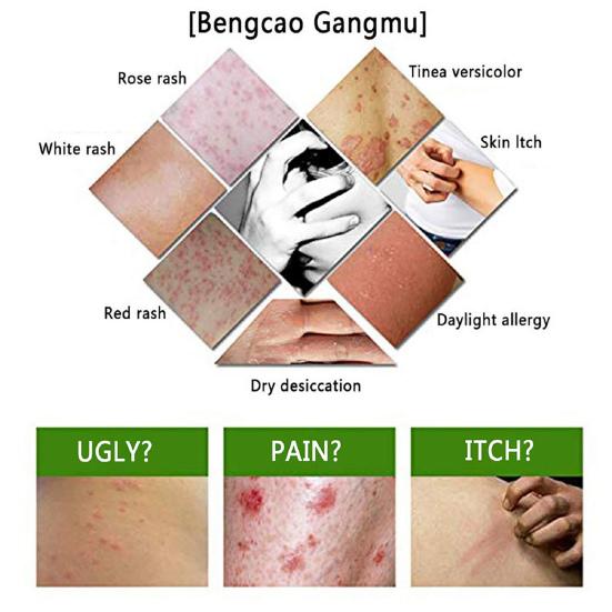 3 Pcs Cream Effective Odorless Lightweight Eczema Dermatitis Chinese Herbal Cream for Daily