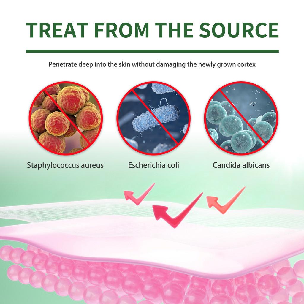 South Moon Nail Repair Foot Mask Nourishing Moisturizing Exfoliating For Cracked Heels