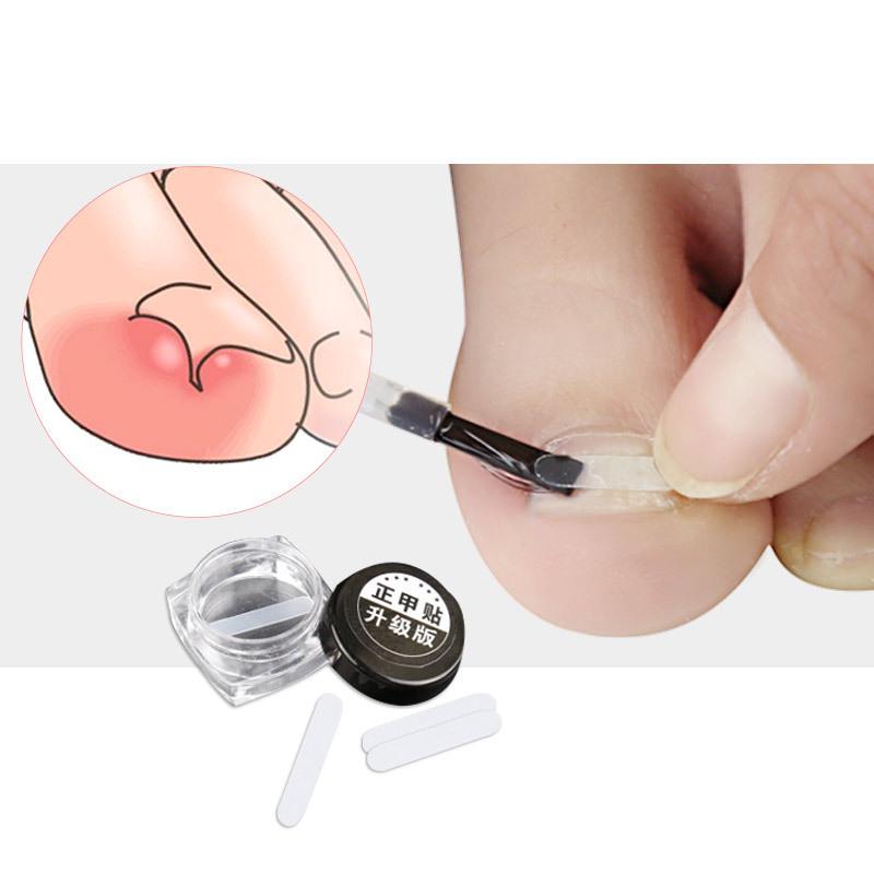 Nail Care Set: Cuticle Pusher, Nail File, Manicure Brush, Nail Buffer, Ingrown Toe Sticker, Pedicure Tools