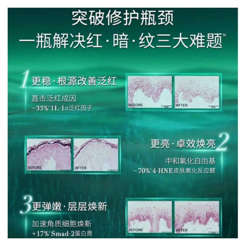Helena liquid essence HR new version of Green Bottle Joyful New Year Limited Gift Box Acne Removal, Soothing, Moisturizing, Repairing 50ml