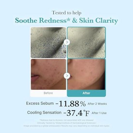 Medikube Azelaic Acid Niacinamide Clear Toner Lotion Oil-Water Balance Sebum Pore Care High Density Oily Skin Skincare Korean Serum Cosmetics