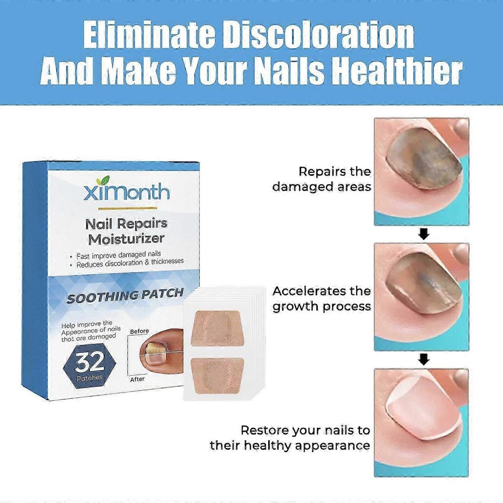 Ximonth Nail Repair Patches For Gray Nails Care, Soft Nails, Ingrown Nails, Thickened Nail Bed, And Nail Brightening Care Patches