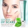 Breylee Acne Scar Removal Cream Stretch Marks Treatment Repairing Skin Care