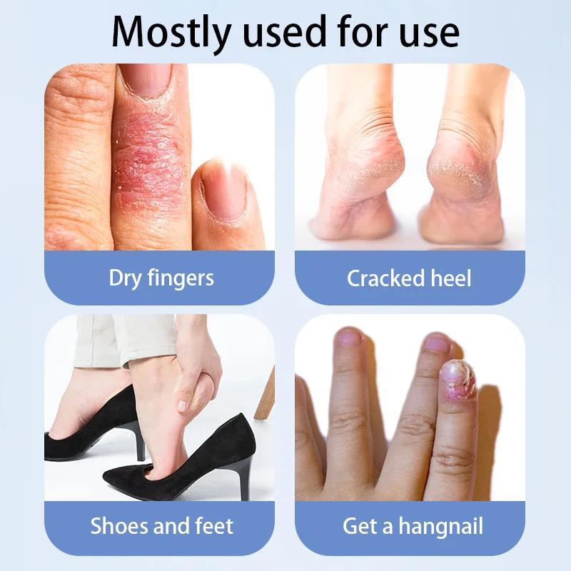 Herbal Cracked Skin Repair Patch - Hand & Foot Care for Dryness, Fissures & Heel Protection Moisturizing
