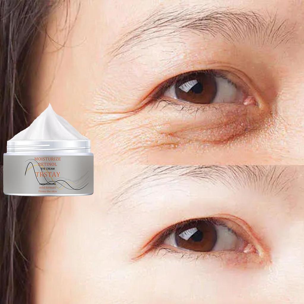 Moisturizing Eye Cream To Reduce Swelling, Mild and Non-irritating, Anti-skin Puffiness, Moisturizing, Anti-aging, Nourishing Skin