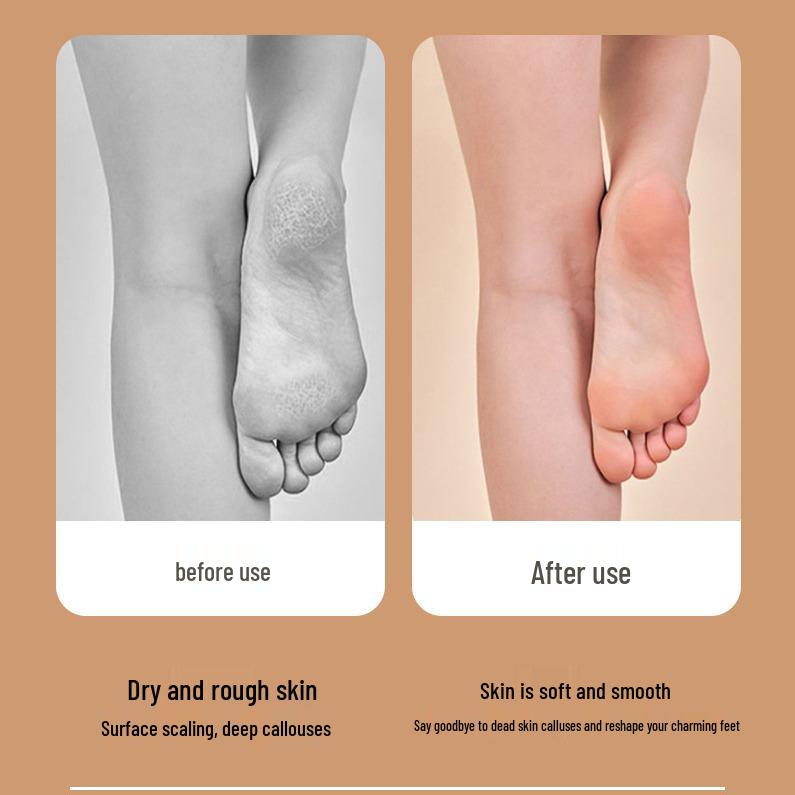 Digital Display Electric Callus Remover & Foot Scrubber Pedicure Tool