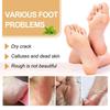 Nourishing Ouhoe Foot Spray For Softening Rough Skin And Removing Dead Skin Cells