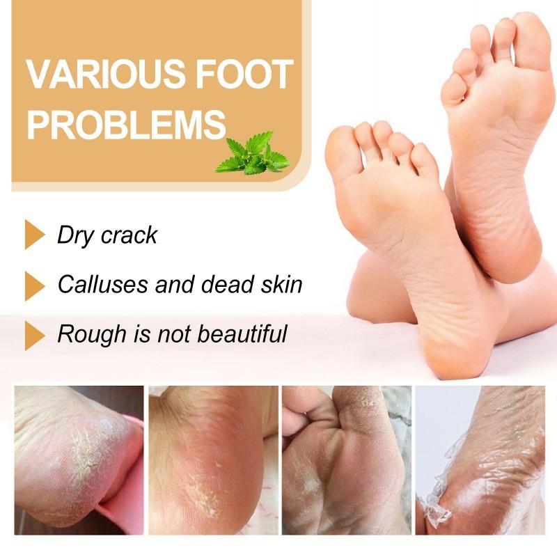Nourishing Ouhoe Foot Spray For Softening Rough Skin And Removing Dead Skin Cells