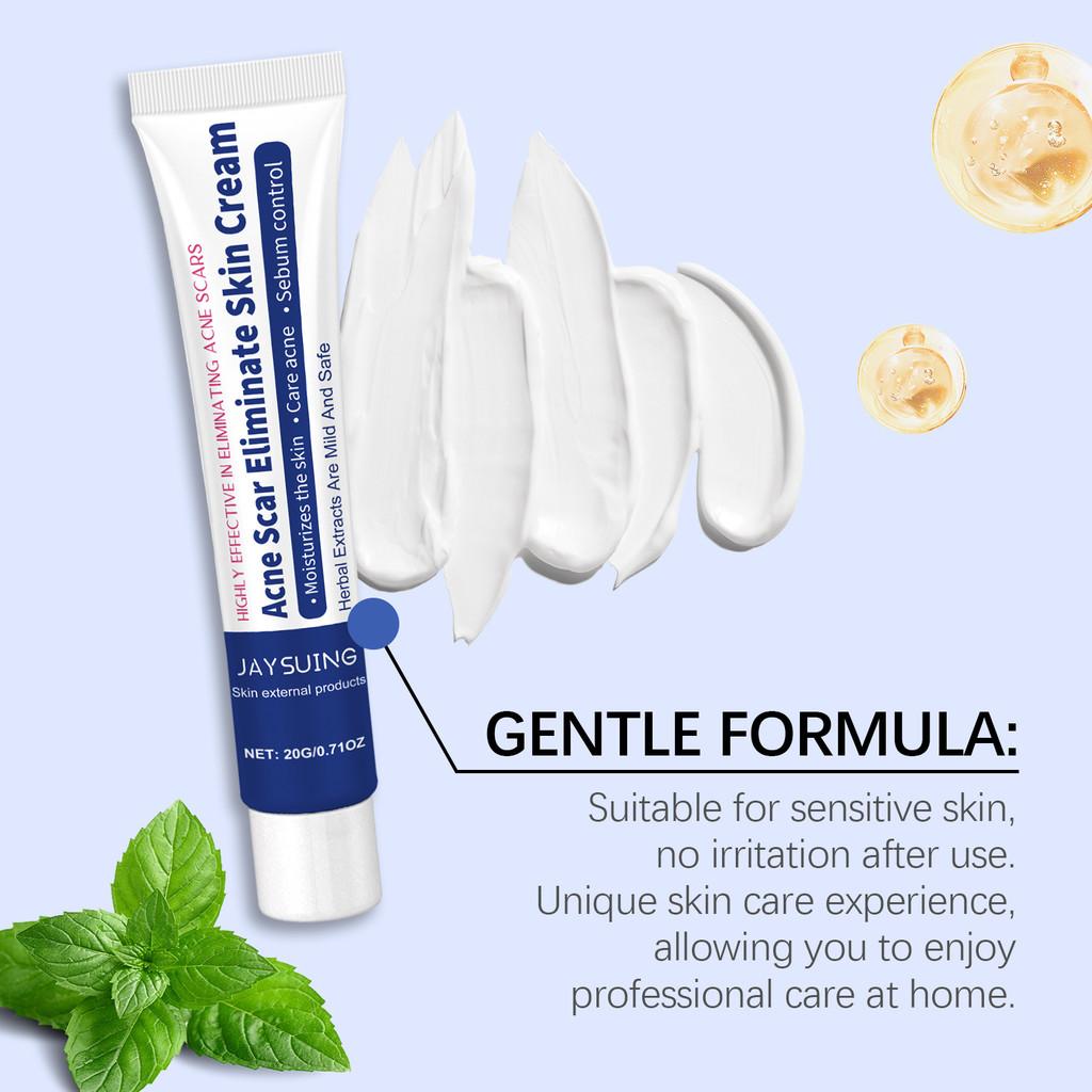 Jaysuing Herbal Acne Cream Refreshing Oil Control Gentle Cleansing Moisturizer For Skin