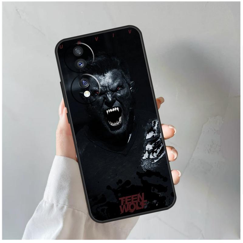 Teen Wolf Case For Honor 90 Lite 50 70 Magic 5 6 Pro X6 X7 X8 X9 X6a X7a X8a X9a X9b X8b Cover Coque