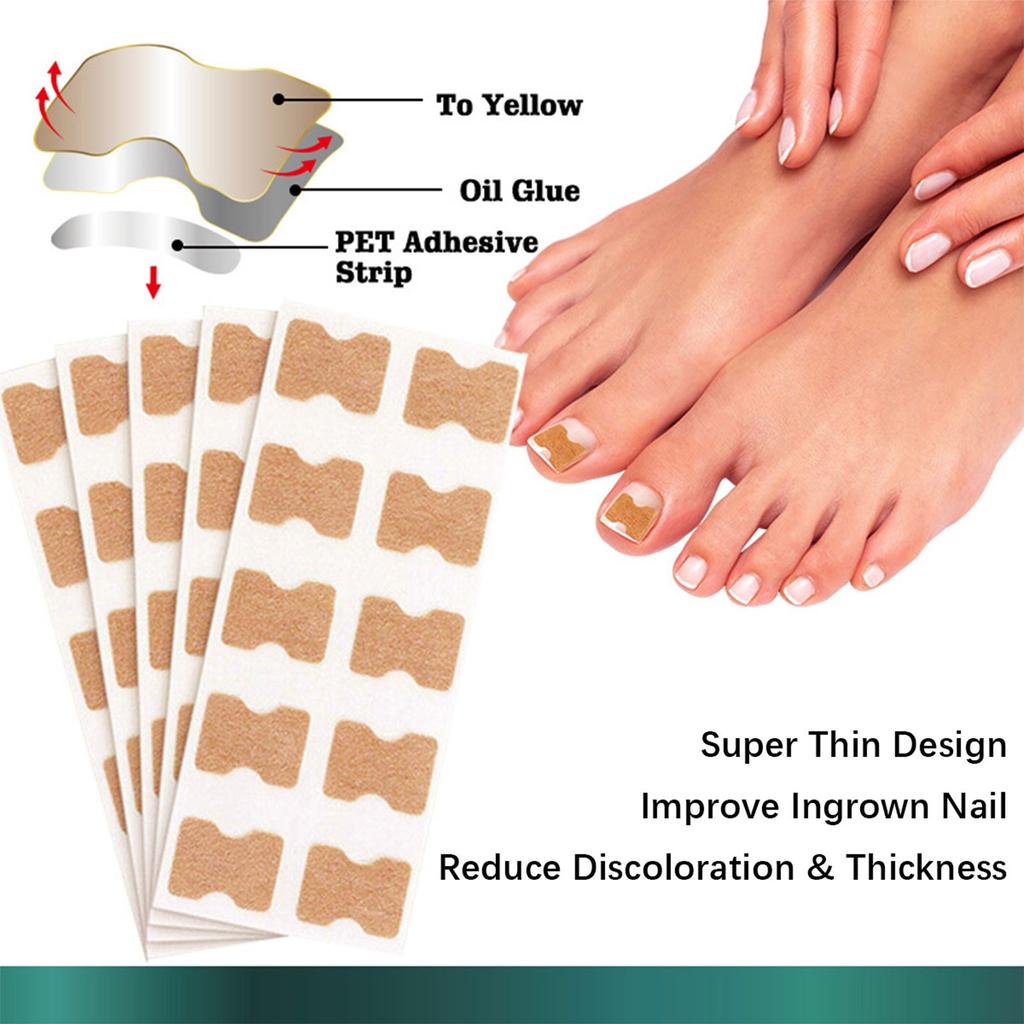 Aufkleber zur Korrektur eingewachsener Zehennägel für Hände und Füße, weicher Nagel, eingelegte Nagelverdickung, helle Nagelfurche, graues Nagelpflegepflaster, 50 Stück
