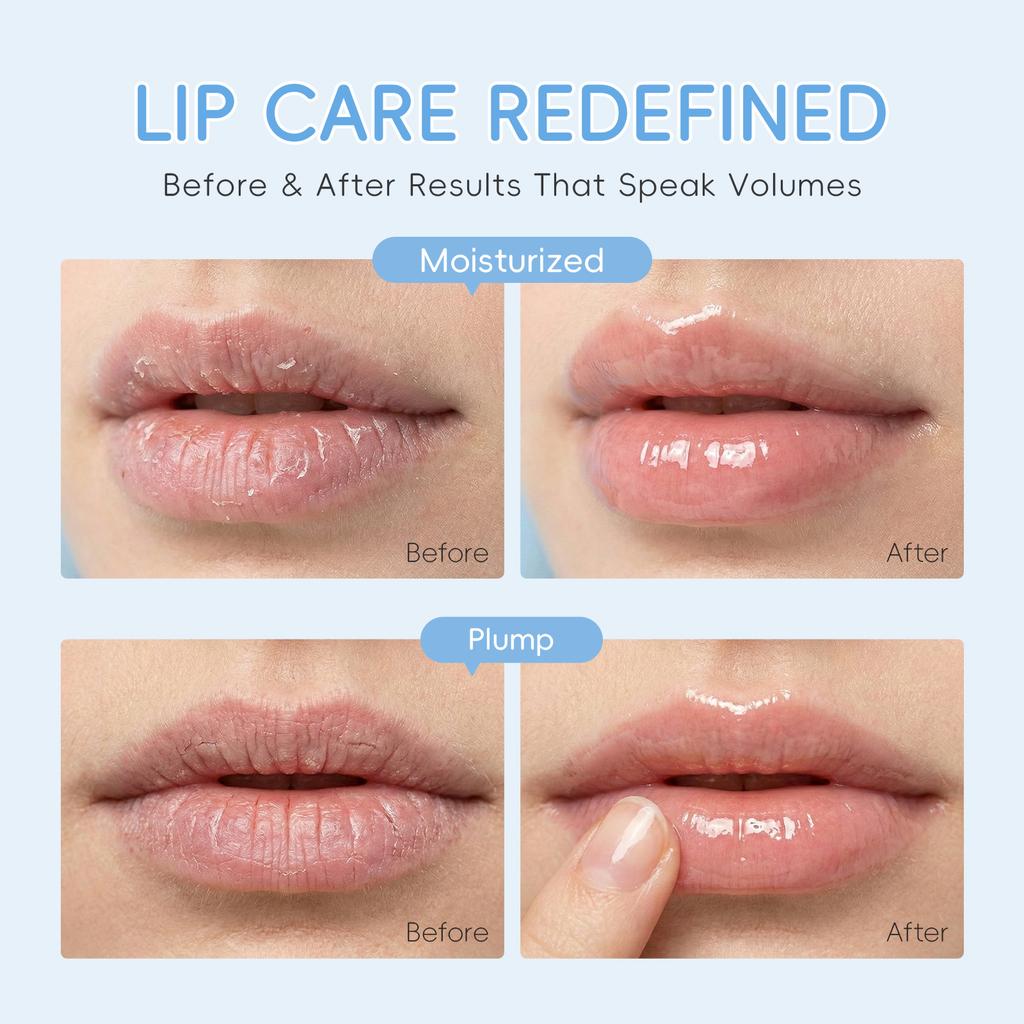 Milk Lip Sleeping Mask 8g – Overnight Nourishing Care with Hyaluronic Acid & Shea Butter, Plump, Hydrate & Smooth Dry Lips