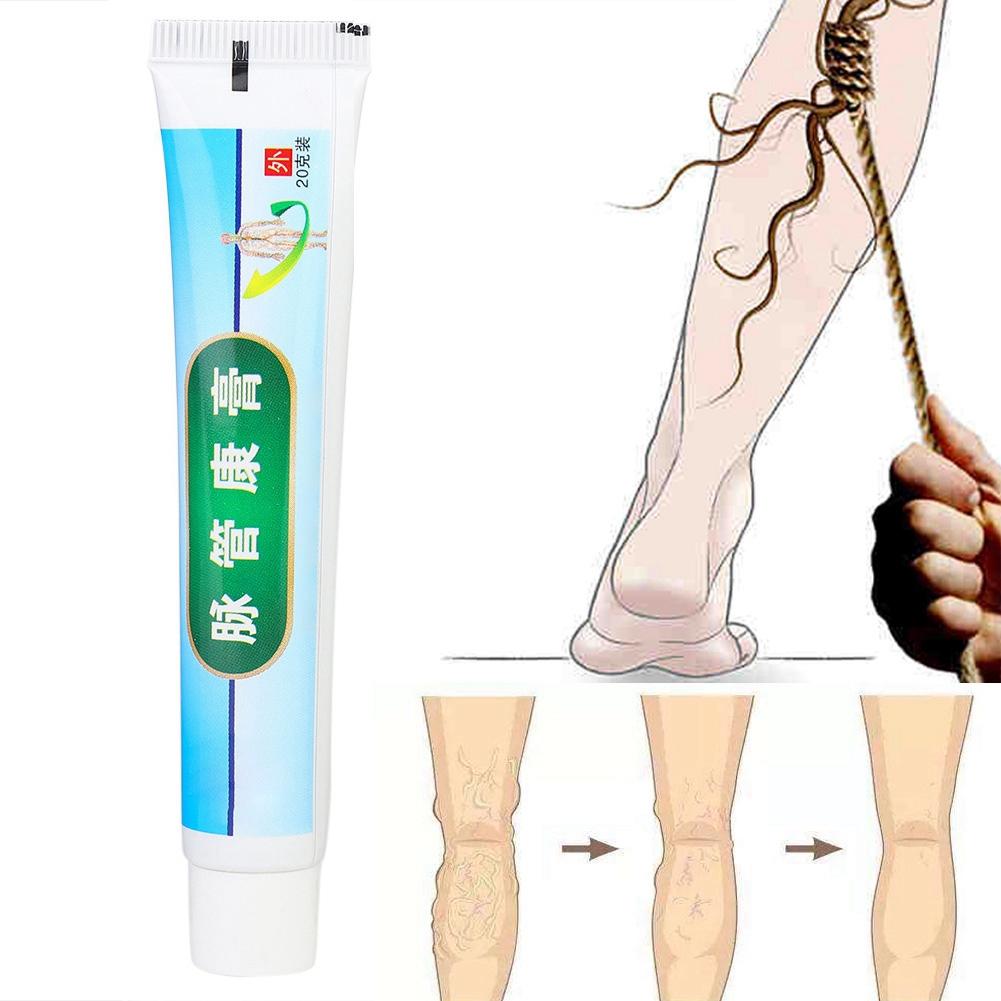 Varicose Vascular Inflammation Massage Cream Treatment Varicose Vein Ointment
