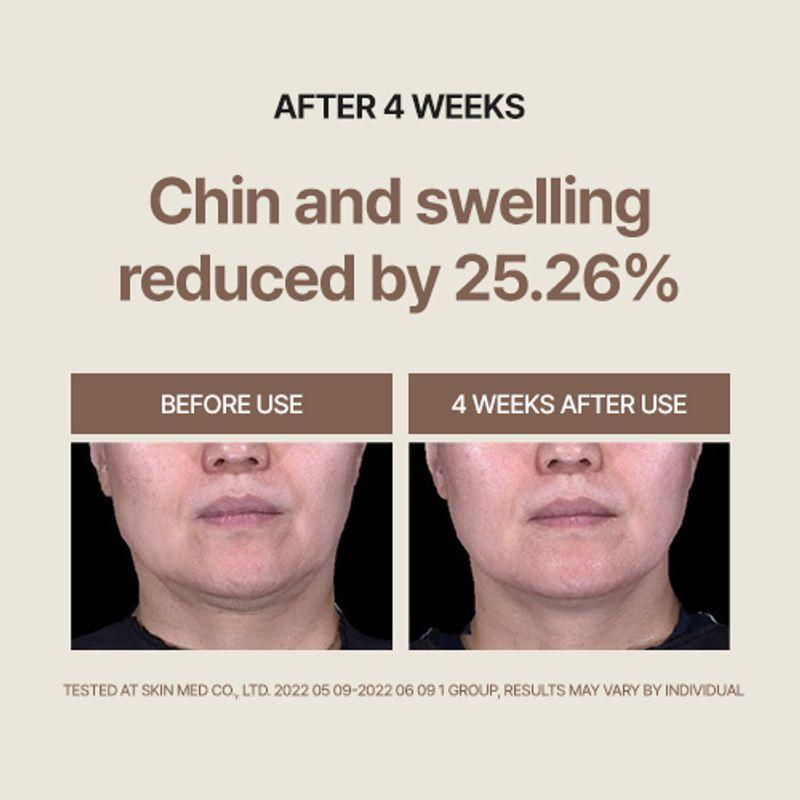 huecalm Birke V-Fit Beruhigende Creme 120ml