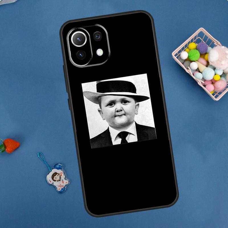 Funny Hasbulla Case For Xiaomi 14 13 15 Ultra 11T 12T 13T 14T Pro POCO X7 Pro X3 X5 F5 F6 M6 X6 Pro Cover