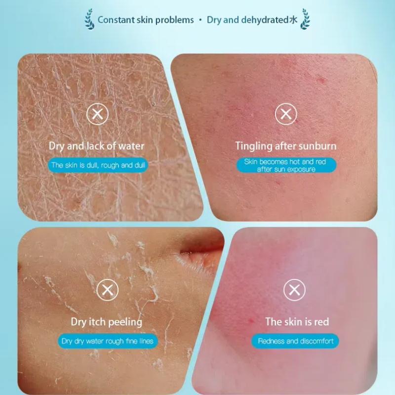 Smoothie Soothing Jelly Mask Moisturizing and Soothing Ceramide NP Witch Hazel Summer After Sun Repair Mask & Cool Deep Hydrating Mask