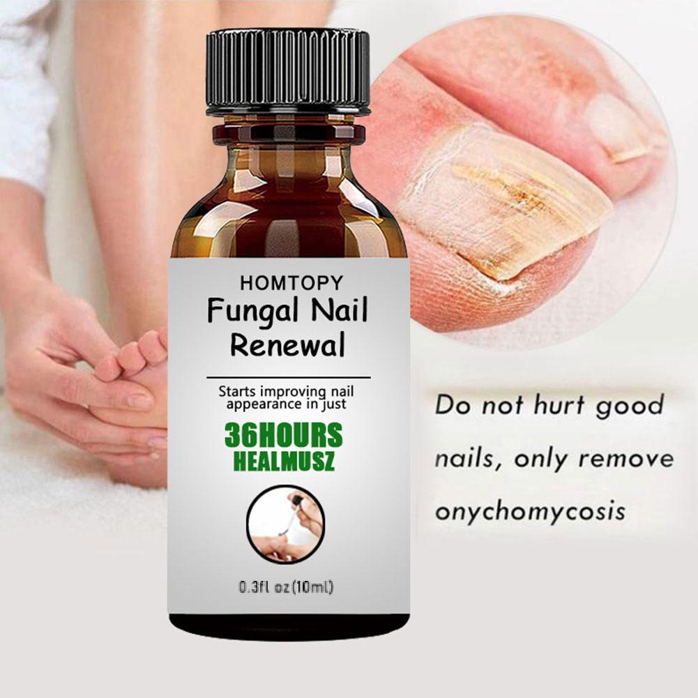 10ML Toenail Nail Fungus Treatment Repair Fingernail Device Foot Toenail Fungus Essential Care F0N3