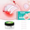 10Pcs Ingrown Toenail Correction Tools Straightening Clip Brace Elastic Patch Sticker Pedicure Tool for Nail Care Treatment