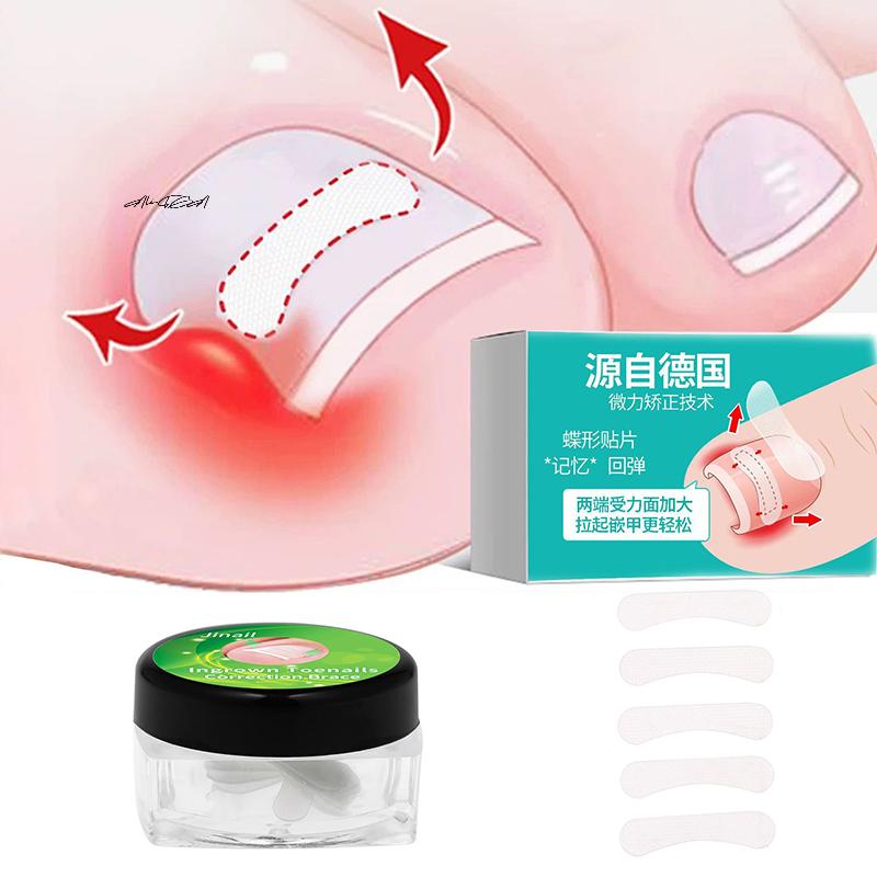 10 sztuk Narzędzia do korekcji wrastających paznokci u stóp Klips prostujący Orteza Elastyczny plaster Naklejka Narzędzie do pedicure do pielęgnacji i leczenia paznokci