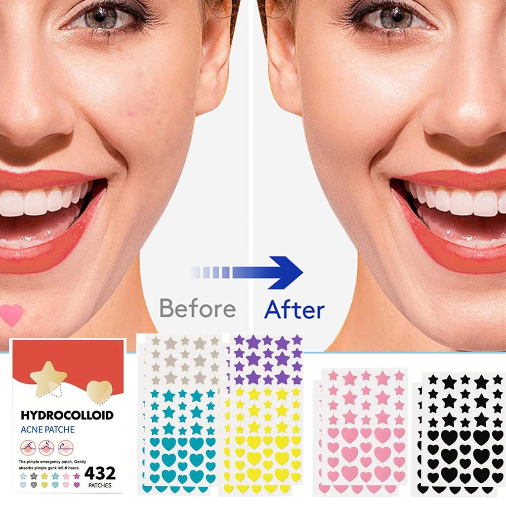 Mixed Color Large Volume Star Acne Patch Mild Non-irritants Fade Acne Acne Closed Mouth Improve Acne Muscle Hydrocolloid