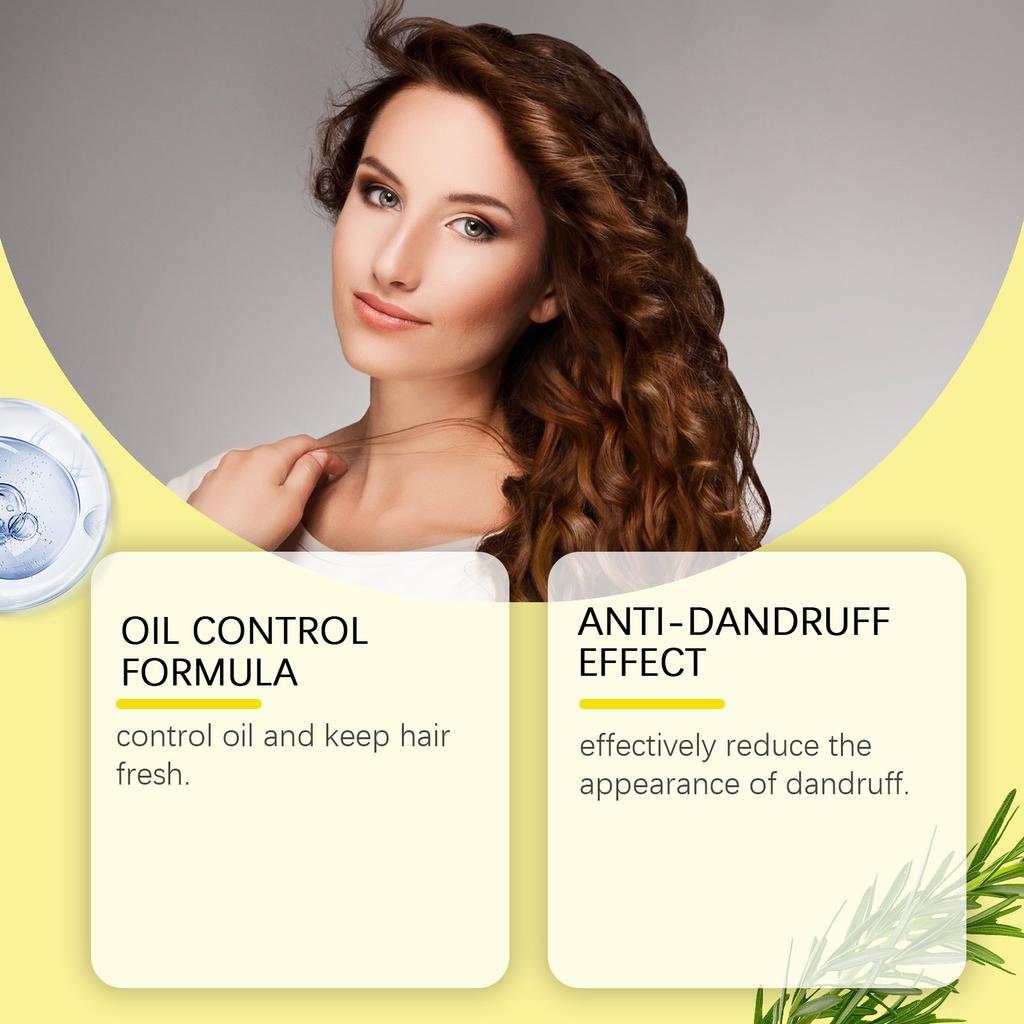 Sulphur Oil Control Anti-Dandruff Shampoo Gently Cleans And Hair And Improves Dry And Frizzy Hair