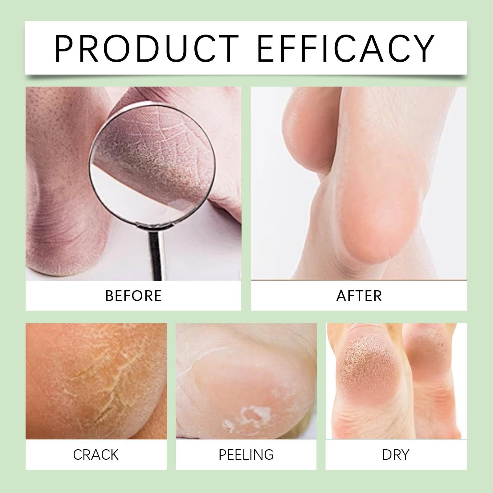 Крем с мочевиной — фото 4