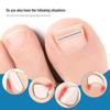 NiTi Alloy Bionic Toenail/Fingernail Corrector for Ingrown Nails