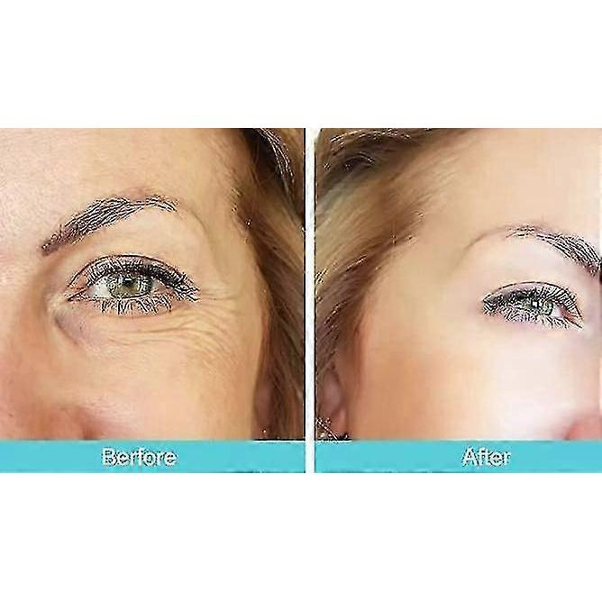 Patchs anti-rides (ensemble de 11 pices) - Patchs anti-rides pour le visage et le front pour rendre les yeux et la bouche lisses, bande de levage