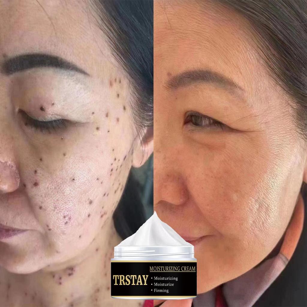 Moisturizing Cream, refreshing and non greasy, mild and non irritating