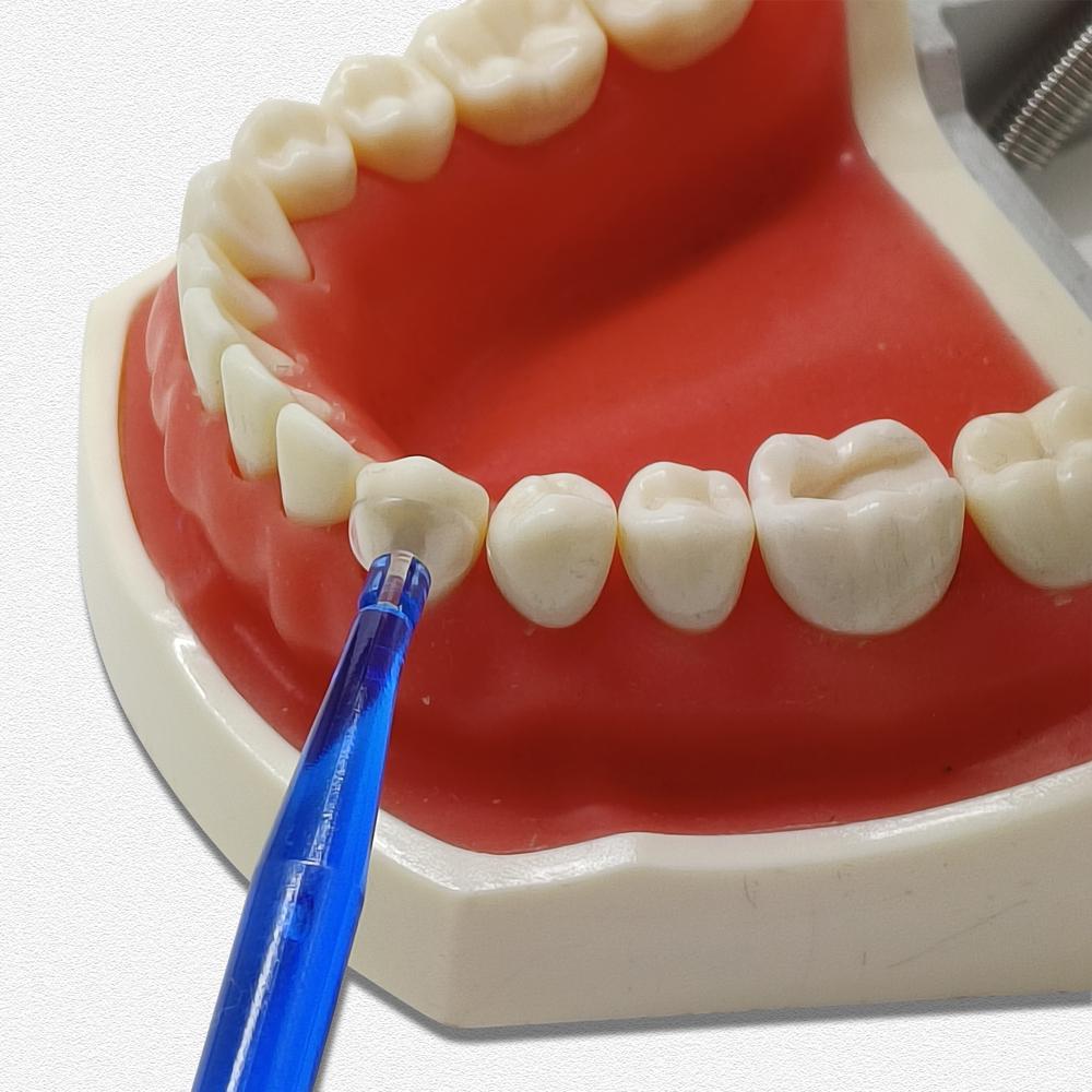 1 Box Dental Transparente Zervikale Matrizen Flexibilität Antihaft-Design Optimale Zahnanpassung Dünne Kanten Kontrolle der Füllung