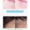 HATHERINE - Spot Care Patch Kit