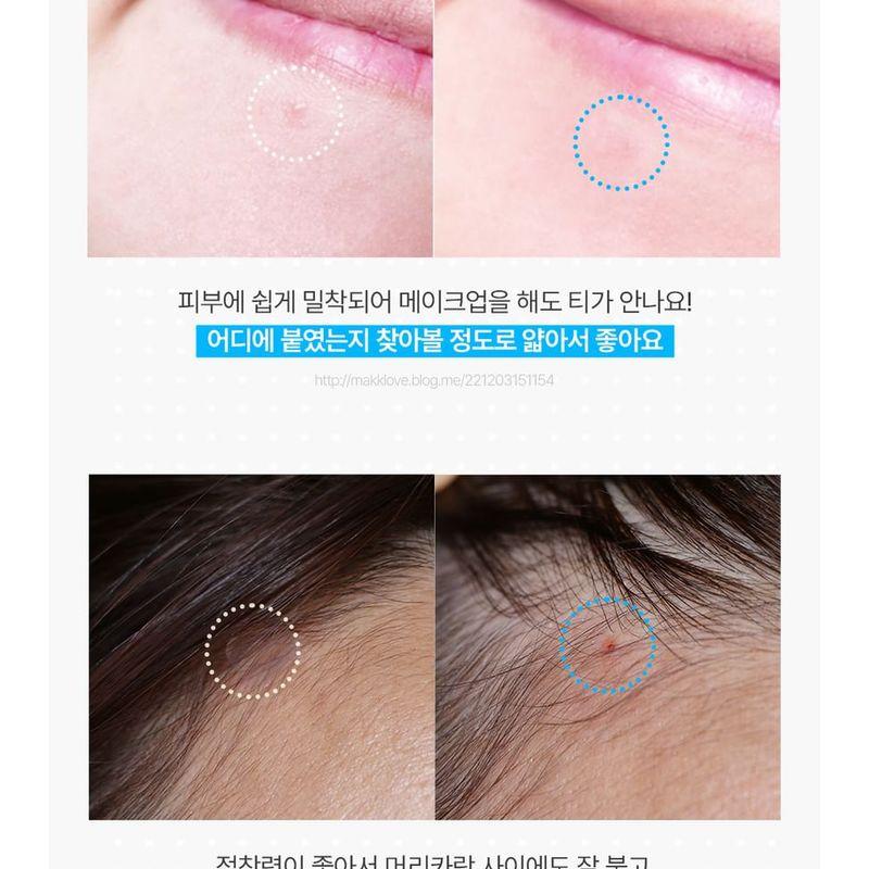 HATHERINE - Spot Care Patch Kit