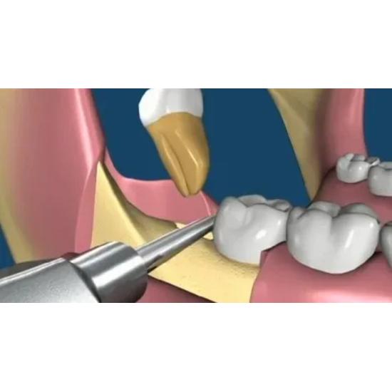 GDC Root Elevator Set Of 9 In Pouch (RESP9)