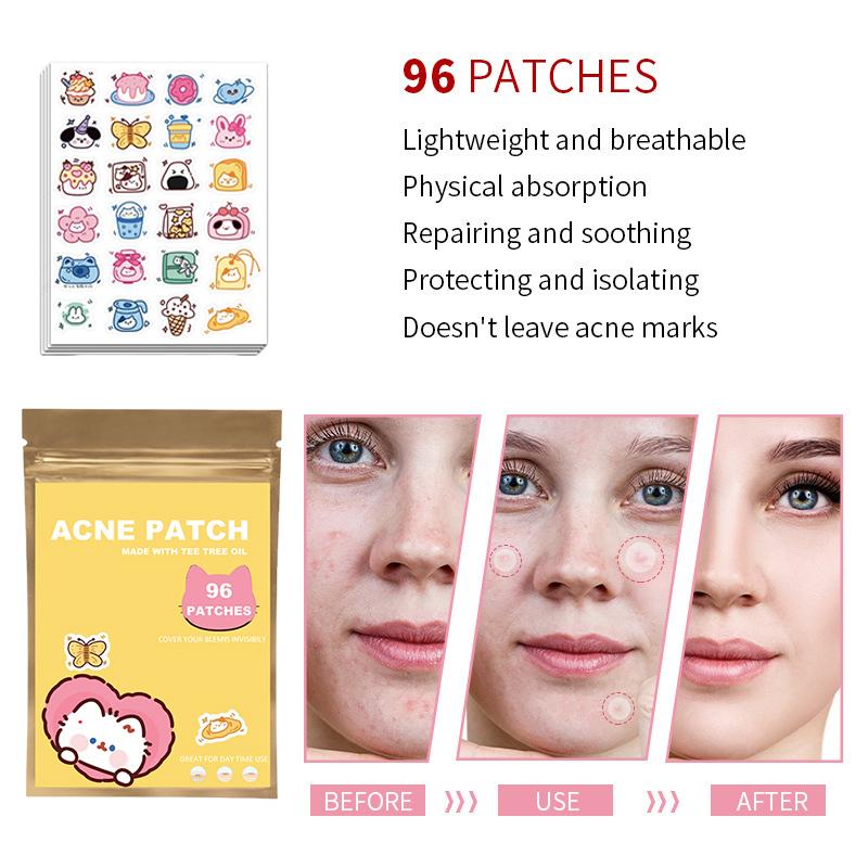 96Pcs Acne Patches Cartoon Cat Shaped Acne Treatment Sticker Invisible Acne Cover Removal Pimple Patch Skin Care