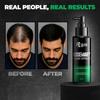 Beardo Rosemary Hair Spray 100 Ml With Redensyl And Rice Water Non Sticky Daily Hair Tonic For Men Frizz Control And Stronger Roots Care