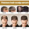 Hair Growth Shampoo, Cleanses And Massages The Scalp, Prevents Hair Loss, Promotes Thicker Hair Roots, And Strengthens Hair.