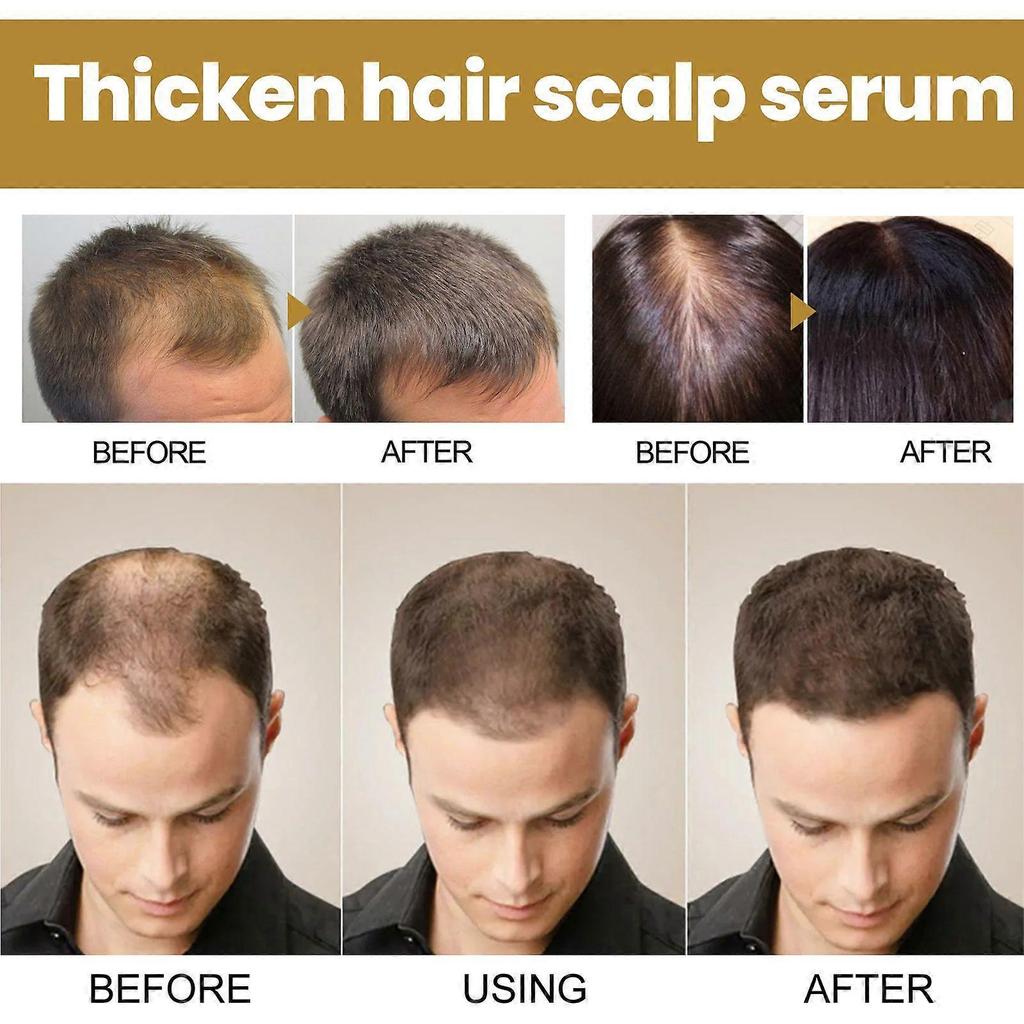 Hair Growth Shampoo, Cleanses And Massages The Scalp, Prevents Hair Loss, Promotes Thicker Hair Roots, And Strengthens Hair.