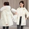 One Dress Three Wear Pie Overcome Women's Removable Liner Cotton-padded Coat Winter New Cotton-padded Jacket Down Cotton-padded Jacket