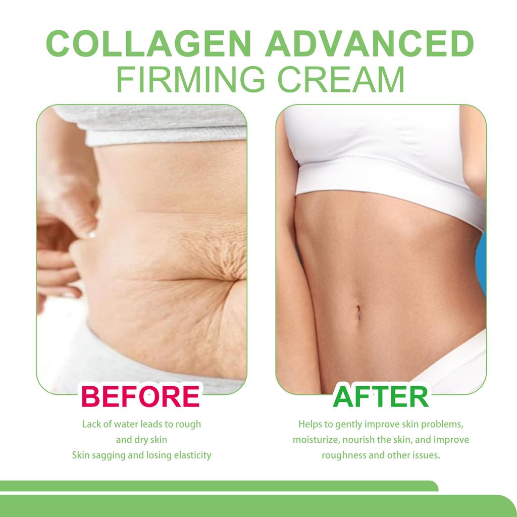 Collagen Firming Body Cream Deeply Moisturizes Skin All Over The Body Soft And Smooth To Improve Dry Rough Firming Cream