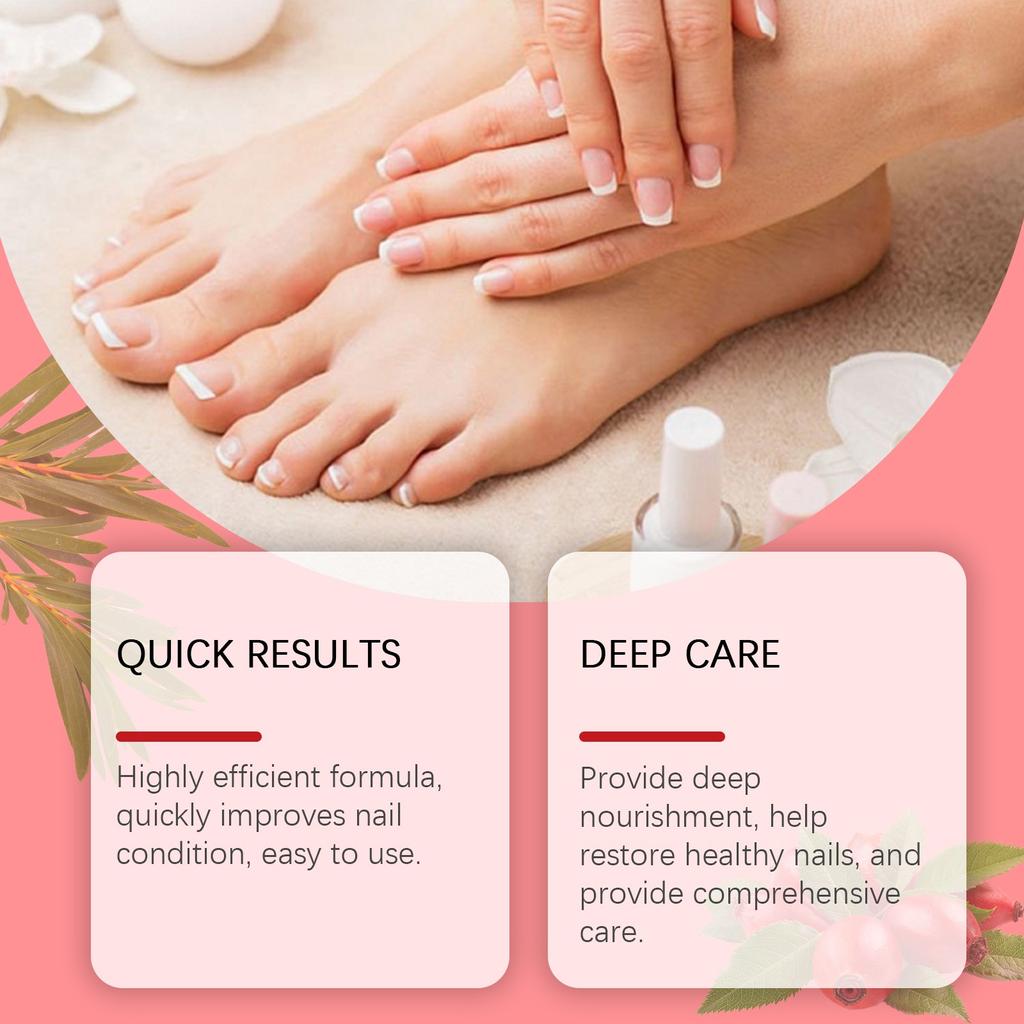 Rosehip Oil Nail Care Liquid Nourishing Moisturizing To Remove Onychomycosis Hand And Foot Nail Care Products Fungus Care 30ML