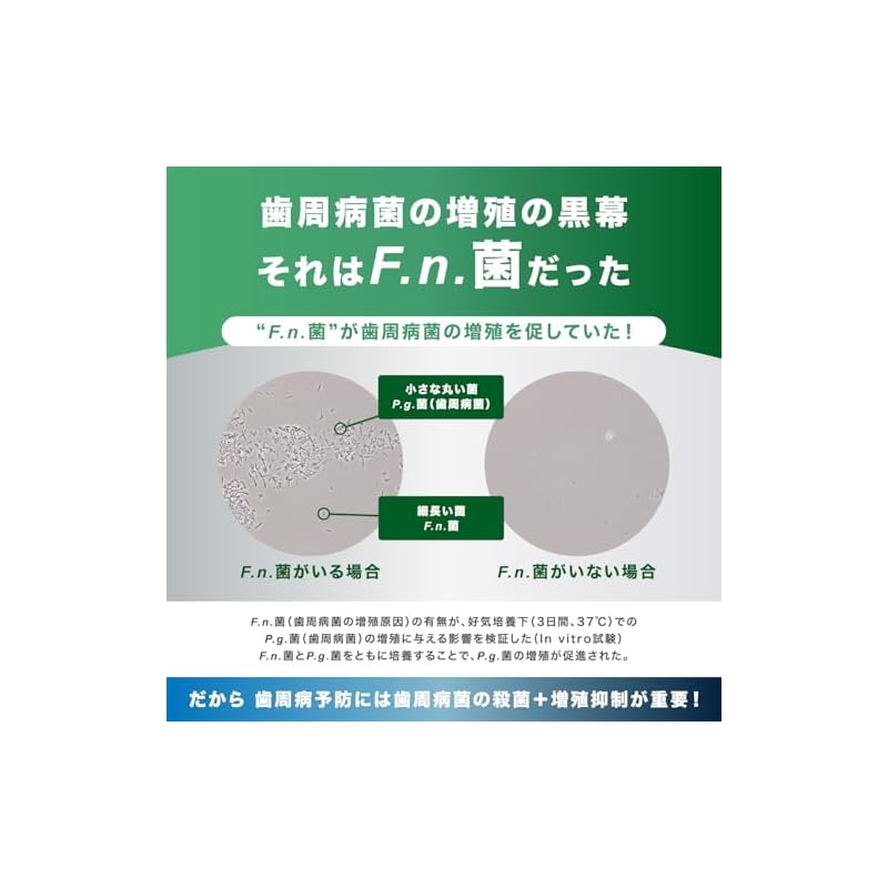 [GUM Plus Dental Paste (Refresh Mint Type) 120g X 2 + Bonus Item] [Quasi-drug]