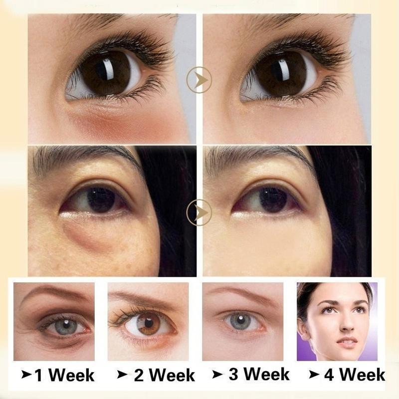 Most Effective Anti-Wrinkle Whitening Skin Care Horse Oil Cream Anti-aging,Anti-wrinkles Face Cream Eye Essence Remove Dark Circles Eye Cream